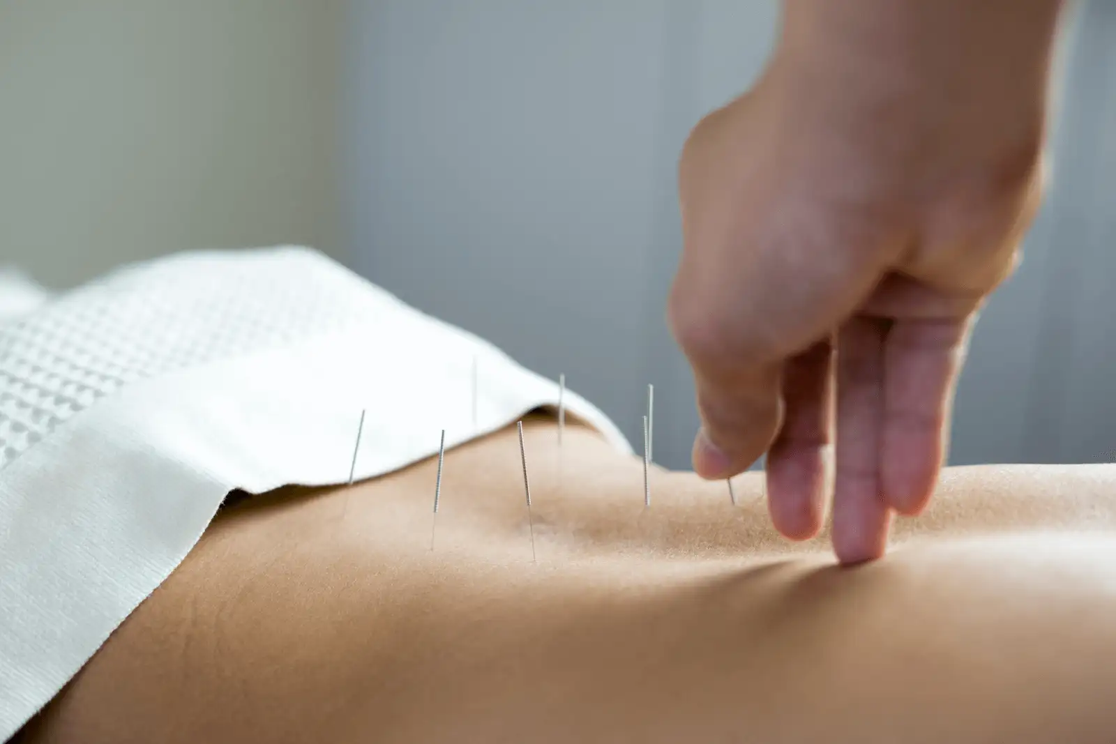 Acupuncture & Cupping